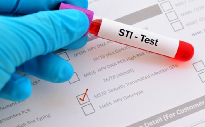 what does sti stand for