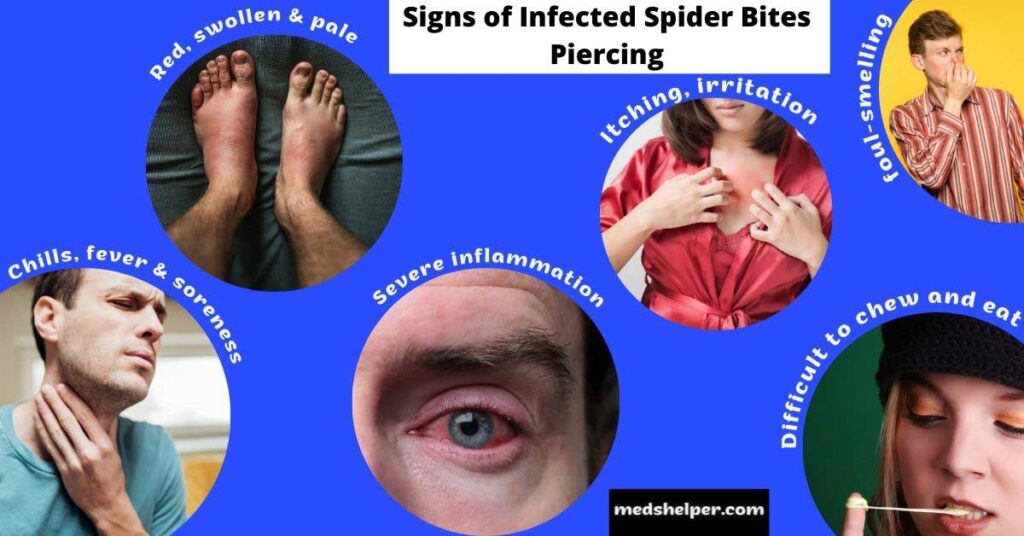 Signs of Infected Spider Bites Piercing