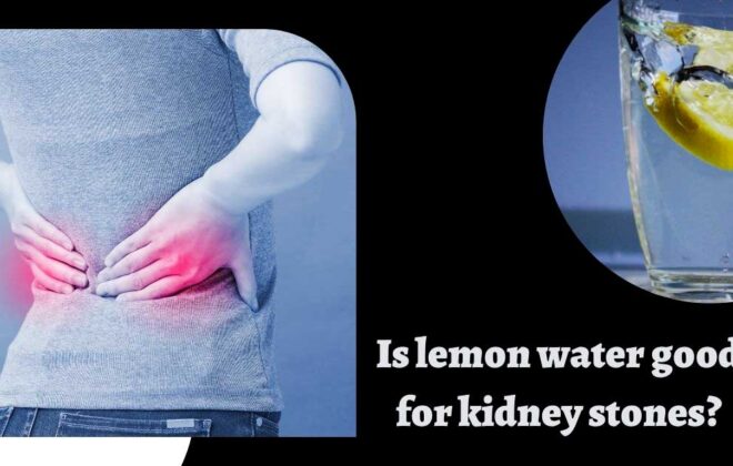 Is lemon water good for kidney stones