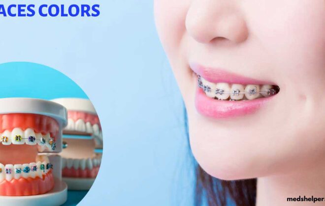 what are the best braces colors