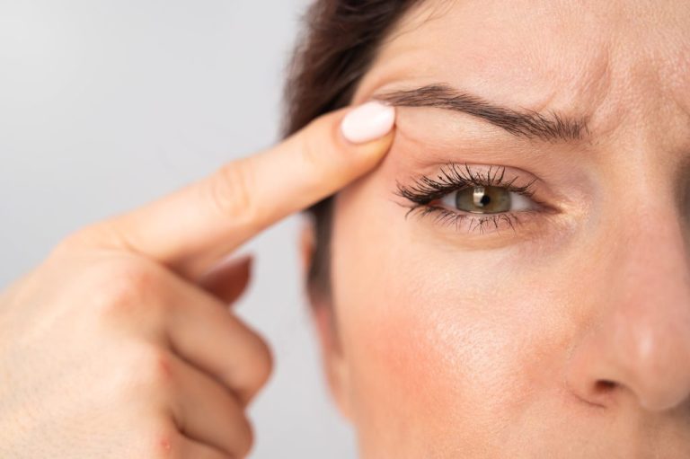 Blepharoplasty in Dubai